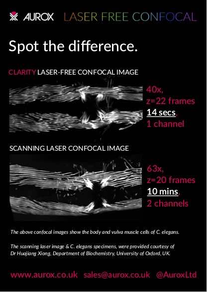 Clarity - Spot the Difference - Laser Free Confocal vs Scanning Laser Confocal